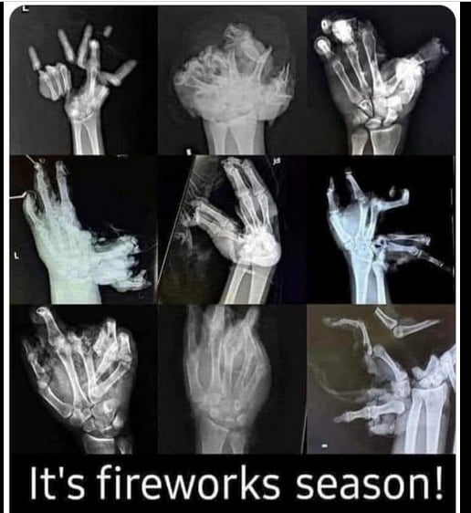 Firework Aftermath Xray Gag