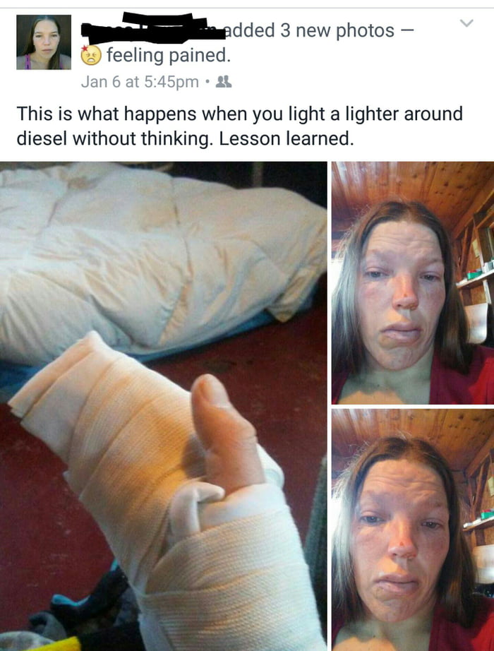 She was checking how much diesel was in a tank by using a lighter to see inside...