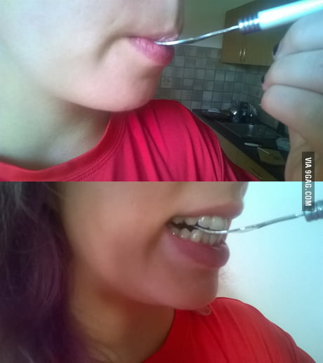 There are 2 kinds of people in this world.  F****** hate hearing sound of teeth scraping on silverware.