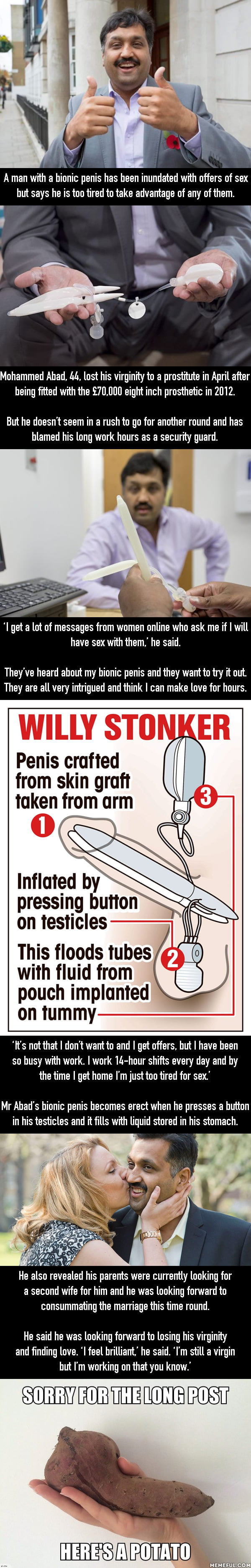 Man with bionic penis is ‘too tired’ to have sex with scores of female admirers