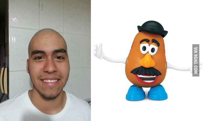 My Friend Looks Like Mr Potato Head Now That He Is Bald 9gag 