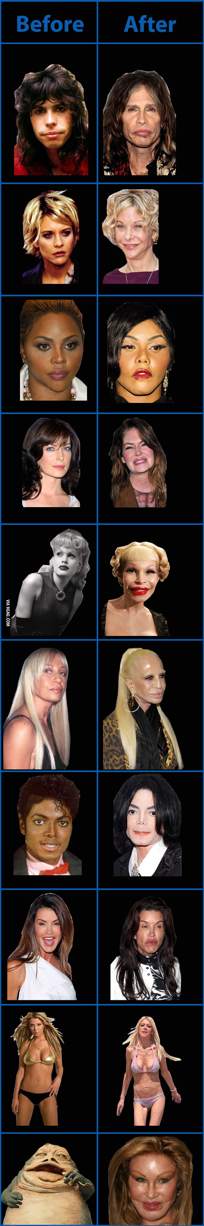 when-plastic-surgery-goes-wrong-9gag