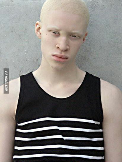 In Case You Were Wondering How An Albino Black Person Looks Like Shaun Ross 9gag