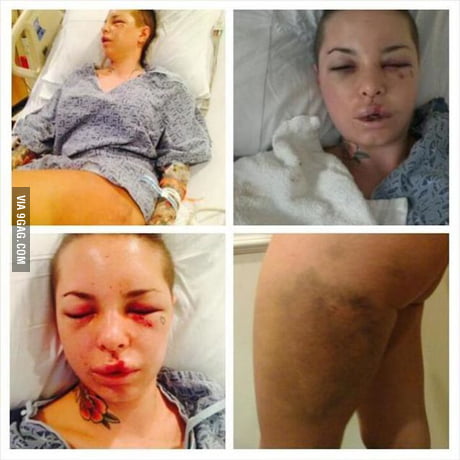 A beaten Christy Mack can barely talk. His exboyfriend, an mma fighter is wanted by the police. - 9GAG