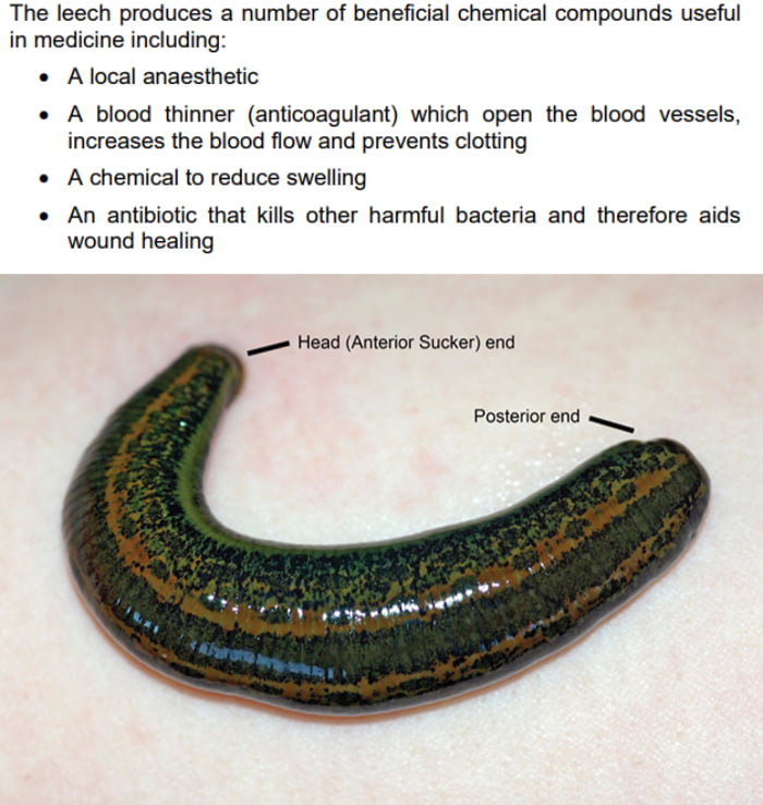 Leeches For Medical Use Today Are Specifically Bred At A Leech Farm In leeches-for-medical-use-today-are-specifically-bred-at-a-leech-farm-in