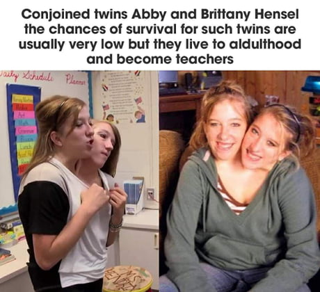 twins abby and brittany hensel