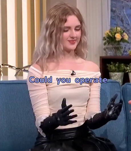 World’s first clinically approved 3D-printed bionic arm