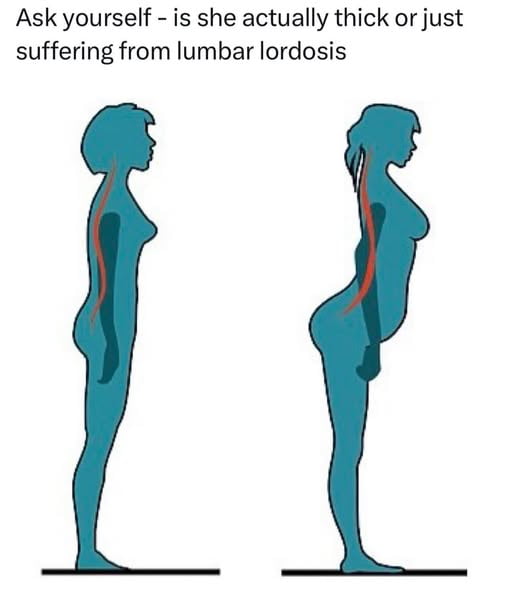 Dang gurl… yo lumbar lordosis is ferocious