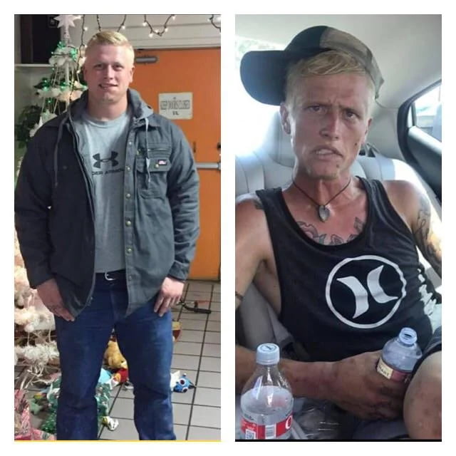 The mother shows what seven months of heroin and meth addiction can do