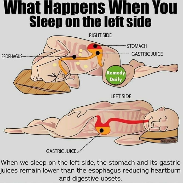 sleeping-on-your-left-side-reduces-heart-burn-9gag