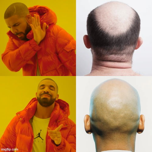 If you are going bald, just shave your entire head. A shaved head always looks better.
