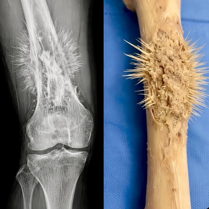 This looks painful.