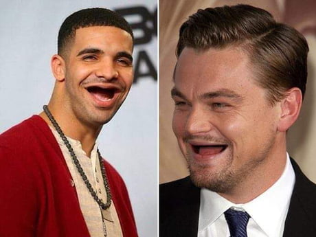 celebrities with no teeth