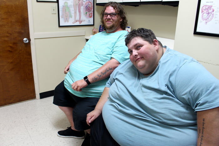 Is this how poverty looks like in your country? The United States is one of the few countries where obesity and poverty are strongly correlated.
