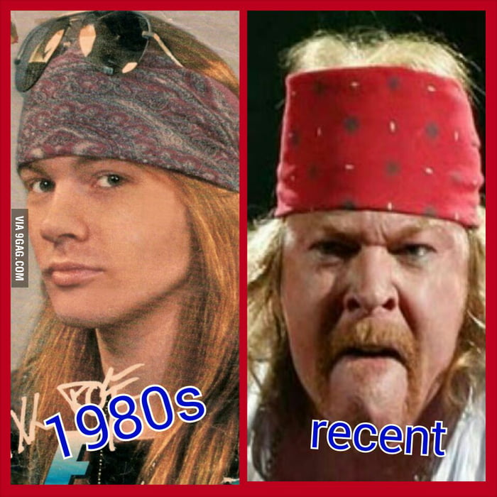 Axl Rose (Guns 'N Roses) Then and now