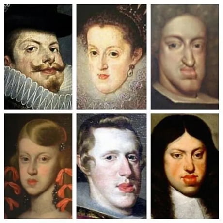 The Habsburg Jaw. Hunderds of years of good ol’ inbreeding. Beauties, ain’t they?