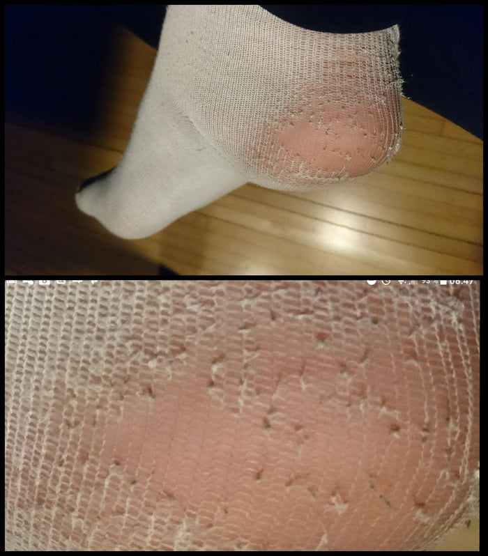 What do you mean by hole in my sock?