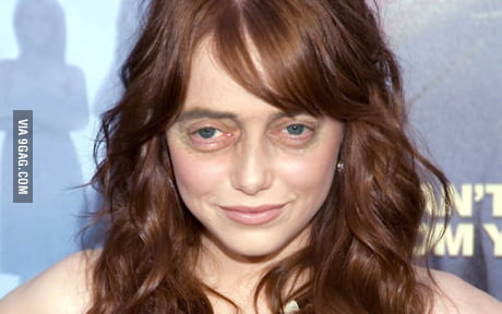 Emma Stone with Steve Buscemi s eyes 9GAG