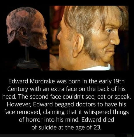 Edward mordrake