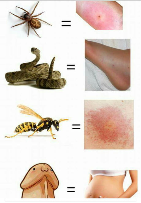 Love Bites 9gag