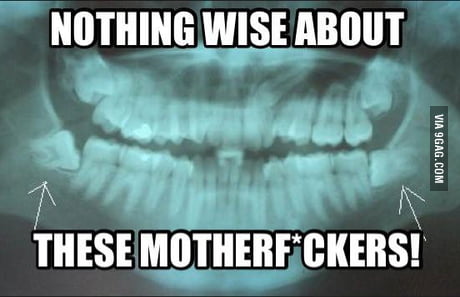 funny wisdom teeth quotes