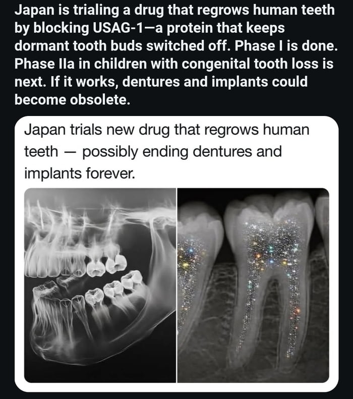One of the Science breakthroughs that I AM GLAD I'm still hearing about it