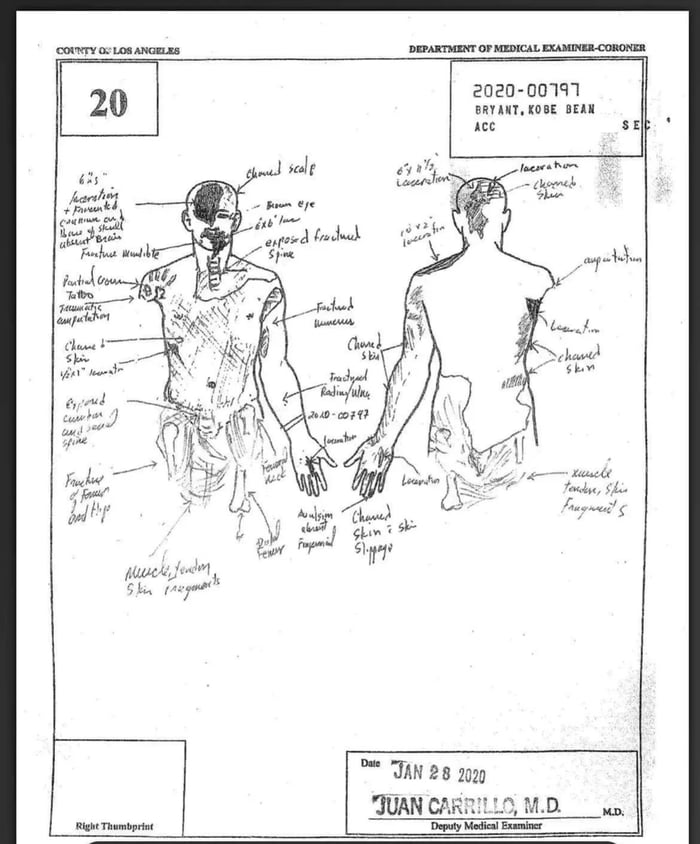 Late Basketball Legend Kobe Bryant's Crash Autopsy Sketch (Graphic) 9GAG