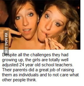 Conjoined twins Brittany & Abby Hensel are an inspiration! - 9GAG