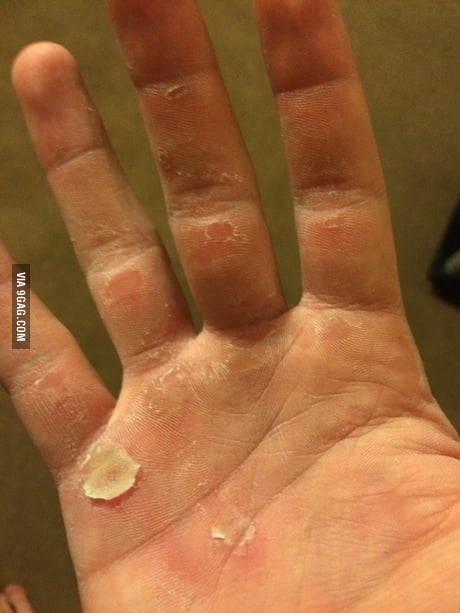 misdrijf Beschrijven explosie To the guy who thought his gym hands are bad - 9GAG