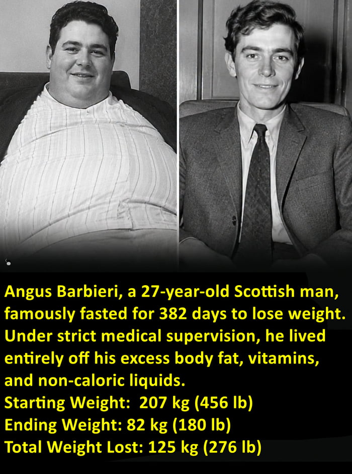 Angus Barbieri (1939–1990) – The world's longest fast