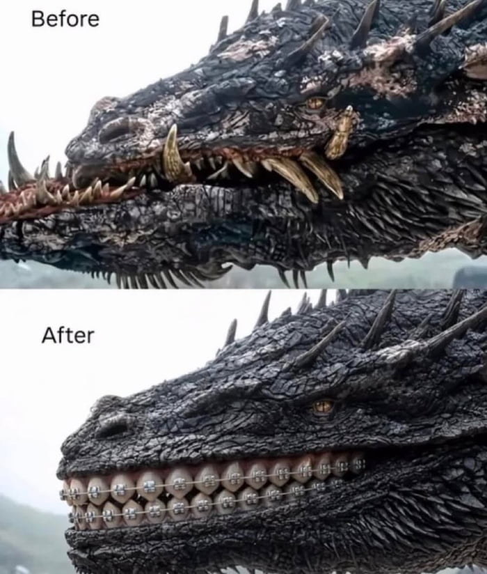 As a Dentist I approve this