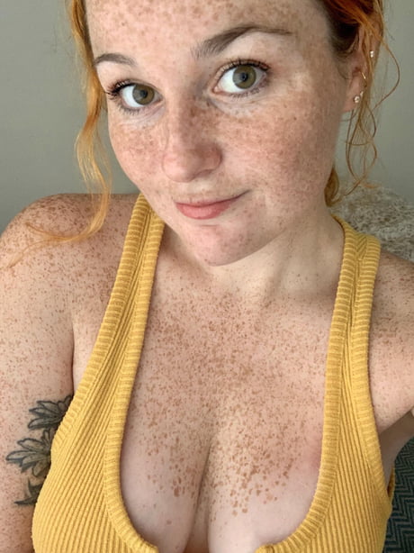 Lots of freckles for your Friday