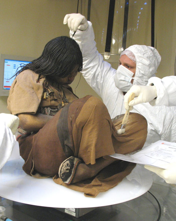 Seen as one of the best preserved mummies to ever be found, this Inca girl was sacrificed to the gods by her tribe in the 1400s. Left to freeze to death in the Andes mountains, she was found over 500 years later in 1999 with hair, blood in her body a