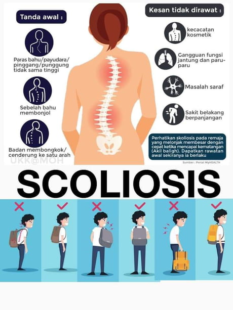 Timbang Beg Sekolah Sek Rendah Boleh Buat Angkat Berat Bhaii 9gag