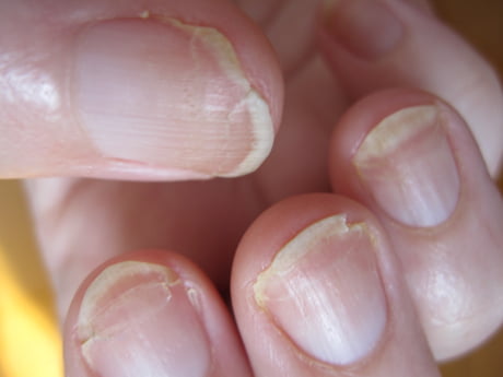 Do this to stop your fingernails from peeling | TheHealthSite.com
