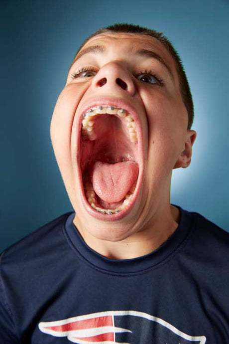 World S Biggest Mouth Guinness World Record - Infoupdate.org