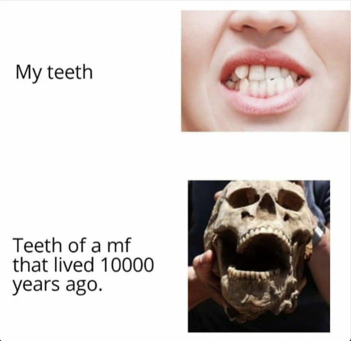 FML