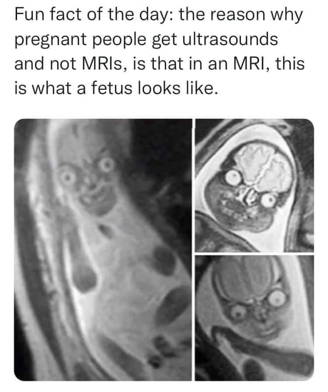 Best Funny ultrasound Memes - 9GAG