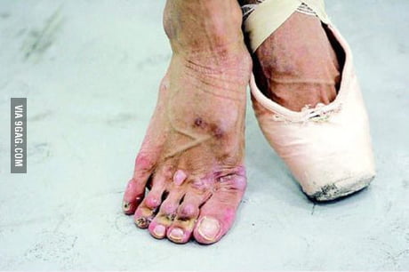 dancers feet after pointe