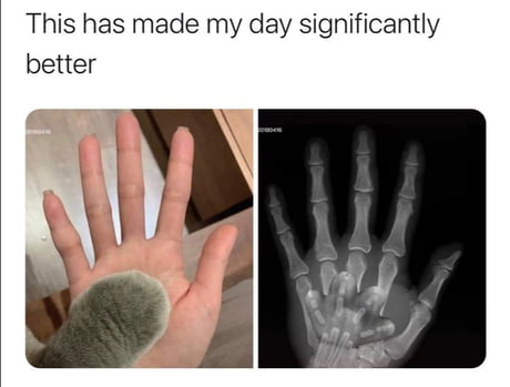Best 30 Xray Fun On 9gag