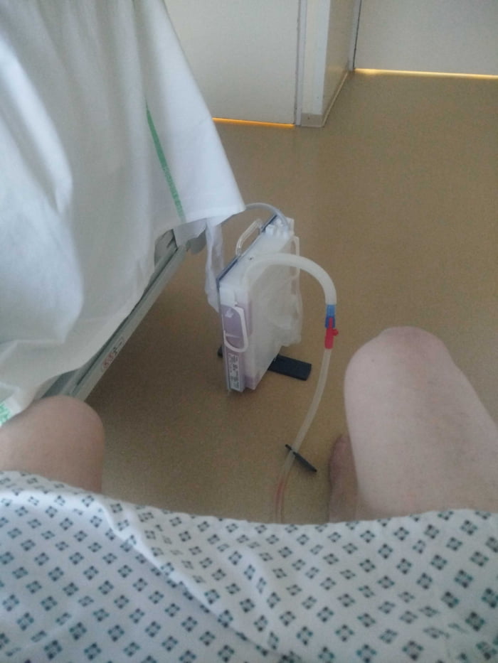 I'm in hospital and I had emergency surgery. Guess what part of my body the tube is stuck in.