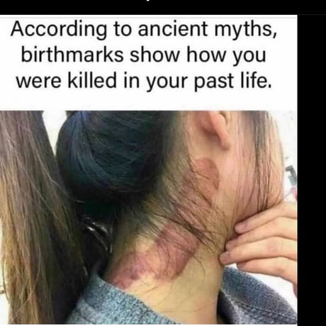 Birthmark Meme