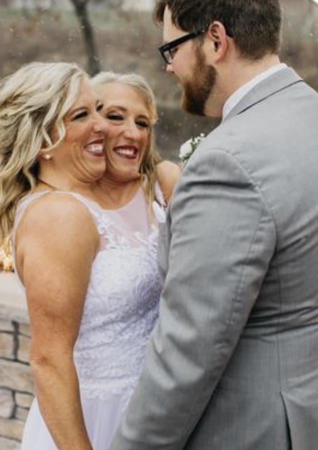Conjoined Twins Got Married 9GAG