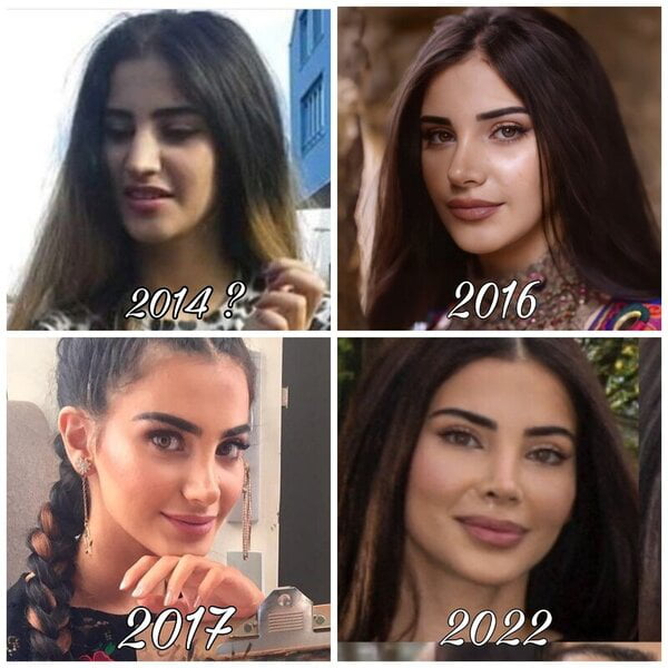 Negin Vand aka Negin Ghalavand before and after - 9GAG