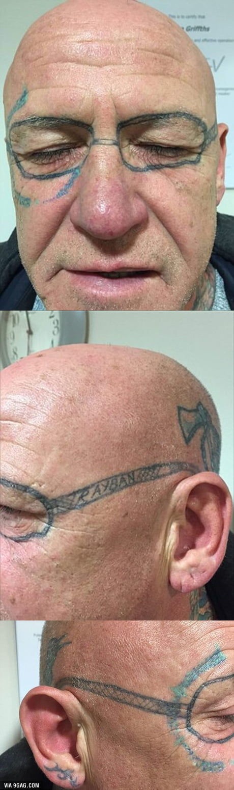 Stag party reveller wakes up to find a pair of 'Ray-Ban' sunglasses tattooed  on his face. (Has gotten most of it lasered off now) - 9GAG