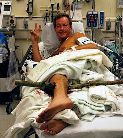 Arrow to the knee = tree branch to the f**kin' shin - 9GAG