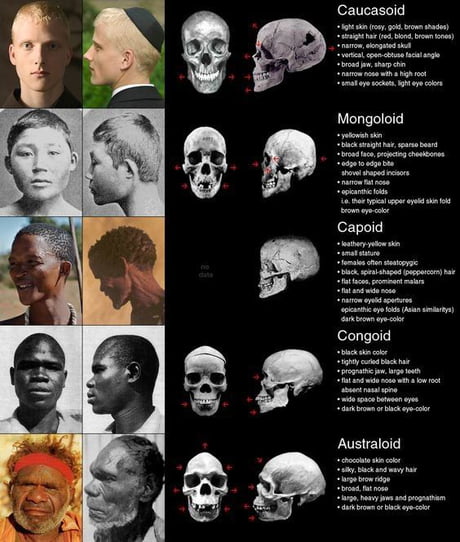 Different Human Skulls By Race Caucasian And Asian Share Similiar Bone Structur To Neanderthaler And Share