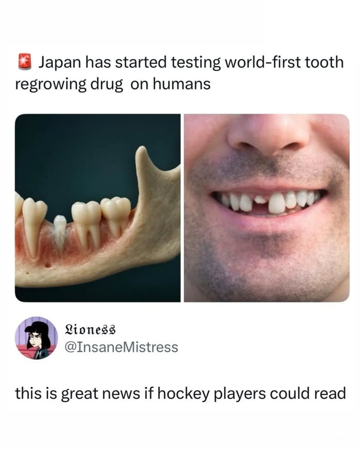 Finally, a solution for hockey players