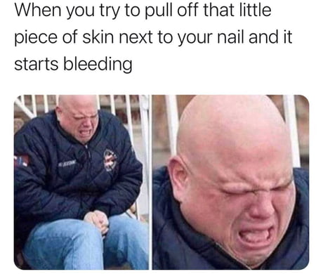 then you try to cut the remaining hangnail so it won t be irritated and end up pulling it back more 9gag