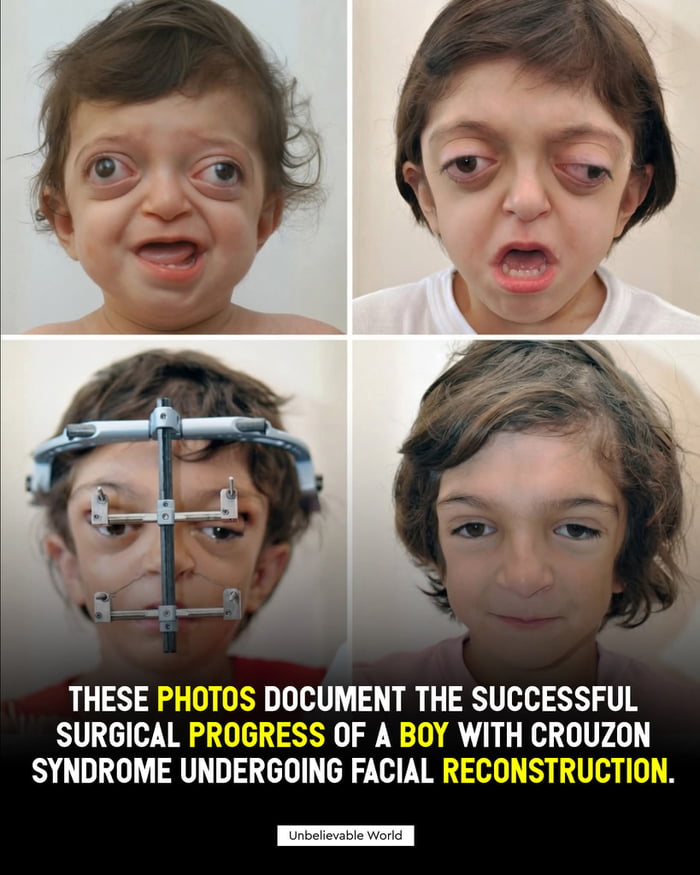 Witness the incredible transformation through four stages of healing.